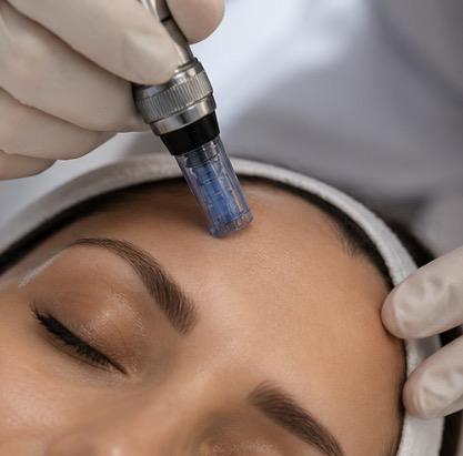 Microneedling skin rejuvenation treatment